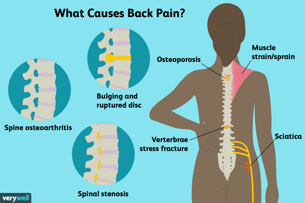 Person experiencing back pain, holding their lower back.